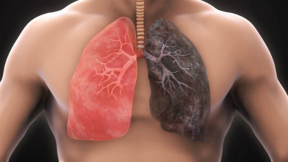 Clean Your Lungs In 3 Days with This Amazing Remedy | Natural Health