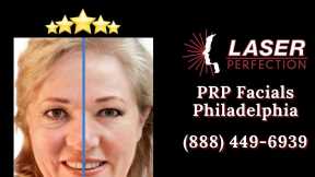 PRP Facial Before and After Philadelphia PA Laser Perfection