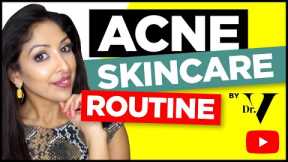 ACNE TREATMENT for Brown/Black skin by DOCTOR V | Get Rid of acne, pimples, zits | Clear Skin | DR V