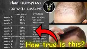 Hair Transplant growth timeline | Month 1-9 | Norwood 5