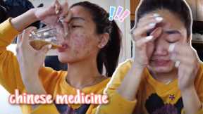 Chinese Herb Medicine For Acne (with result)