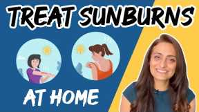 Natural Treatment for Sunburns at Home |  Sunburn Causes & Treatment | Dr. Aanchal