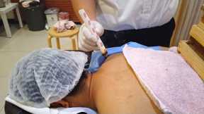 Unreal CHINESE MEDICAL THERAPY That Relieve Back & Shoulder Pains (Moxibustion)