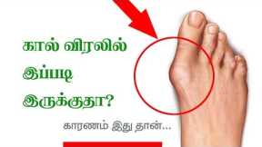 Home Remedies for Rheumatoid Arthritis - Tamil Health Tips