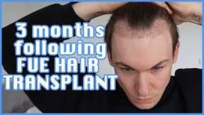 FUE Hair Transplant | Month 3 | Surgery, Swelling, Growth, Before & After, Advice | Progress Update