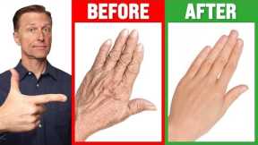#1 Absolute Best Remedy for Dry and Wrinkled Hands