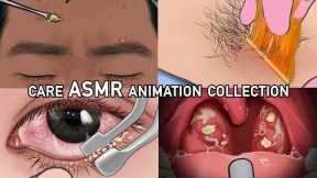 ASMR care animation collection/Pimple Skin Care/Waxing/Eyelid Sebum/tonsillitis & tonsil stone