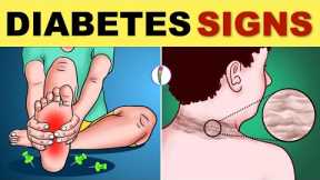 Diabetes Symptoms | Diabetes Mellitus | Type 2 Diabetes - Signs & Symptoms | Diabetes Warning Signs