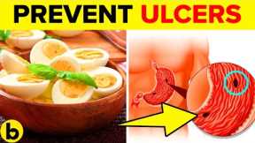 11 Best Foods To Prevent Ulcers