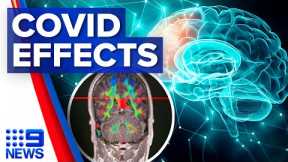 New study reveals potential severe long-term effects of COVID-19 | 9 News Australia