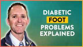 Why Do Your Feet Swell When You Have Diabetes | Diabetes Peripheral Neuropathy | Mastering Diabetes