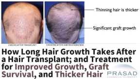 How Long Hair Regrowth Takes after a Hair Transplant, and Improving Growth Rate and Results