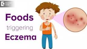 Foods triggering eczema flare up | Help your child avoid the itch! - Dr. Udhay Sidhu