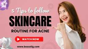 Best Skincare routine for Acne