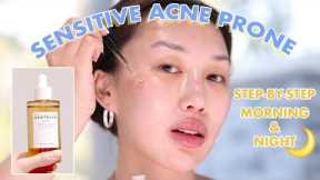 Korean Skincare for Acne Prone Skin *WHOLE ROUTINE*