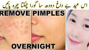 Reduce Pimples Acne Naturally At Home | How To Get Flawless Glass Skin | Glowing Skin Face Pack