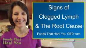 The Root Cause of Clogged Lymphatic System
