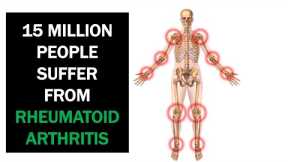 Natural Remedies For Rheumatoid Arthritis That Work