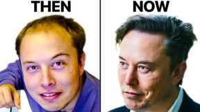 Elon Musk's Hair Transplant | Surgeon Reacts