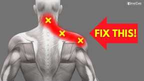 How to INSTANTLY Fix Pinched Nerve Pain in the Neck and Shoulders