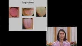 Tongue Diagnosis - Traditional Chinese Medicine and Acupuncture