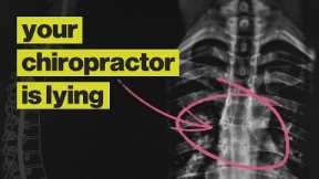 Chiropractors Are Not What You Think They Are
