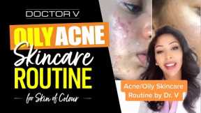 Doctor V - Oily, Acne Skincare Routine For Skin of Colour | Brown Or Black Skin | #shorts