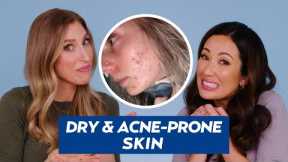 Acne-Prone, Dry Skin Skincare Routine for Nicole! | DERMATOLOGIST REACTS