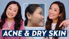 Best Skincare Routine for Acne & Dry Skin? Dermatologist Advice for Lisa! | DERMATOLOGIST REACTS