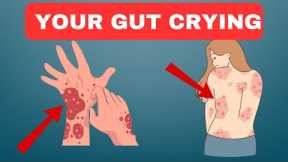 Poor Gut Health: 7 Signs That Your Gut is Crying for Help