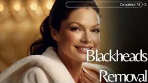 Skincare | Blackheads Removal #073 #skincare skincare #blackheads blackheads
