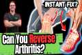 BEST 5 Ways to STOP Arthritis Pain