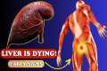 LIVER is DYING! 12 Weird Signs of