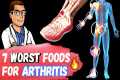 🔥7 WORST Foods for Arthritis &