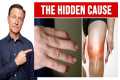 The Hidden Cause of Arthritis in Your 