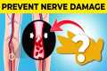 Top 10 Ways To Prevent Nerve Damage