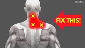 How to Fix Neck and Upper Back Pain FOR GOOD