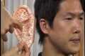 Auricular Acupuncture - Traditional