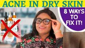 8 STEPS TO REMOVE ACNE FROM DRY & TEXTURED SKIN | Best Acne Treatment For Dry Skin - Simply Shuga