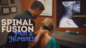 Neck Pain, Spinal Fusion, Numbness & Tingling in The Hands Helped - Dr. Daryl Gonstead Chiropractor