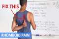 How to Fix Upper Back / Rhomboid Pain 