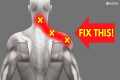 How to INSTANTLY Fix Pinched Nerve