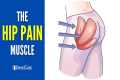 The Hip Pain Muscle (How to Release