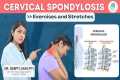 Cervical Spondylosis Exercises |Neck