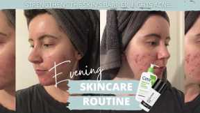 Evening Skincare Routine FOR ACNE-PRONE SKIN | The Ordinary, CERAVE, The Inkey List