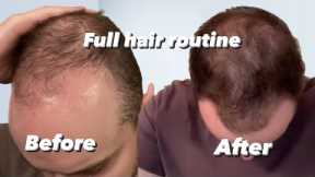 The Hair routine that saved my hair… (Reversing hair loss: EP 2)