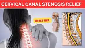 Cervical Canal Stenosis in Tamil | Exercises for Neck Pain Relief | Dr shanmuga pillai PT | Tamil |