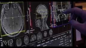 What We’ve Learned Treating 4,000 Patients With Long COVID-19