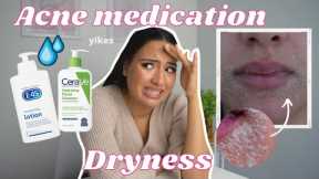 HOW TO FIGHT ACNE MEDICATION DRYNESS |DRY SKIN FROM TRETINOIN, BENZOYL PEROXIDE, ACCUTANE, DIFFERIN