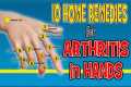 10 Home Remedies for Arthritis in